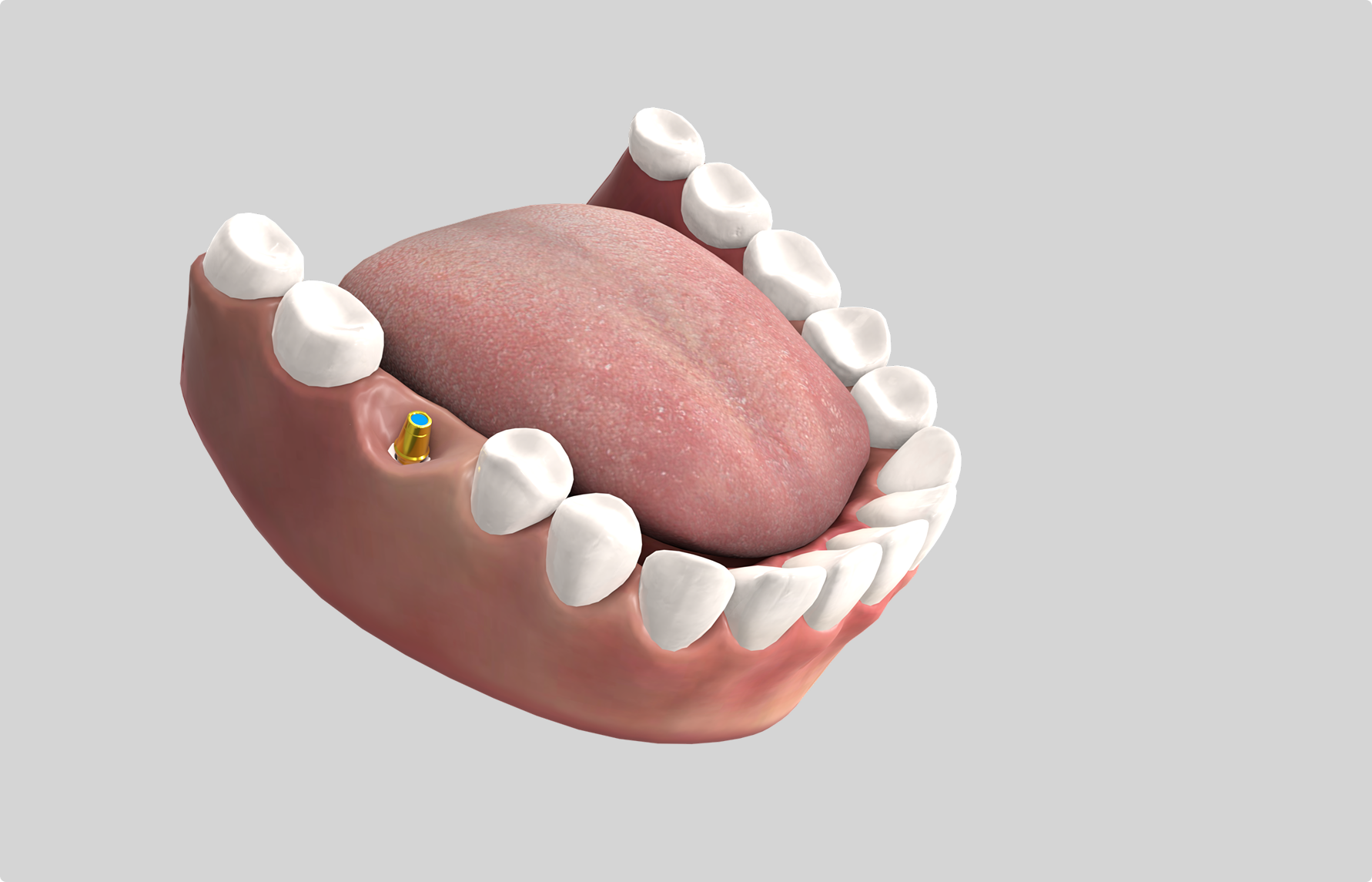 Dental scene, alternative angle
