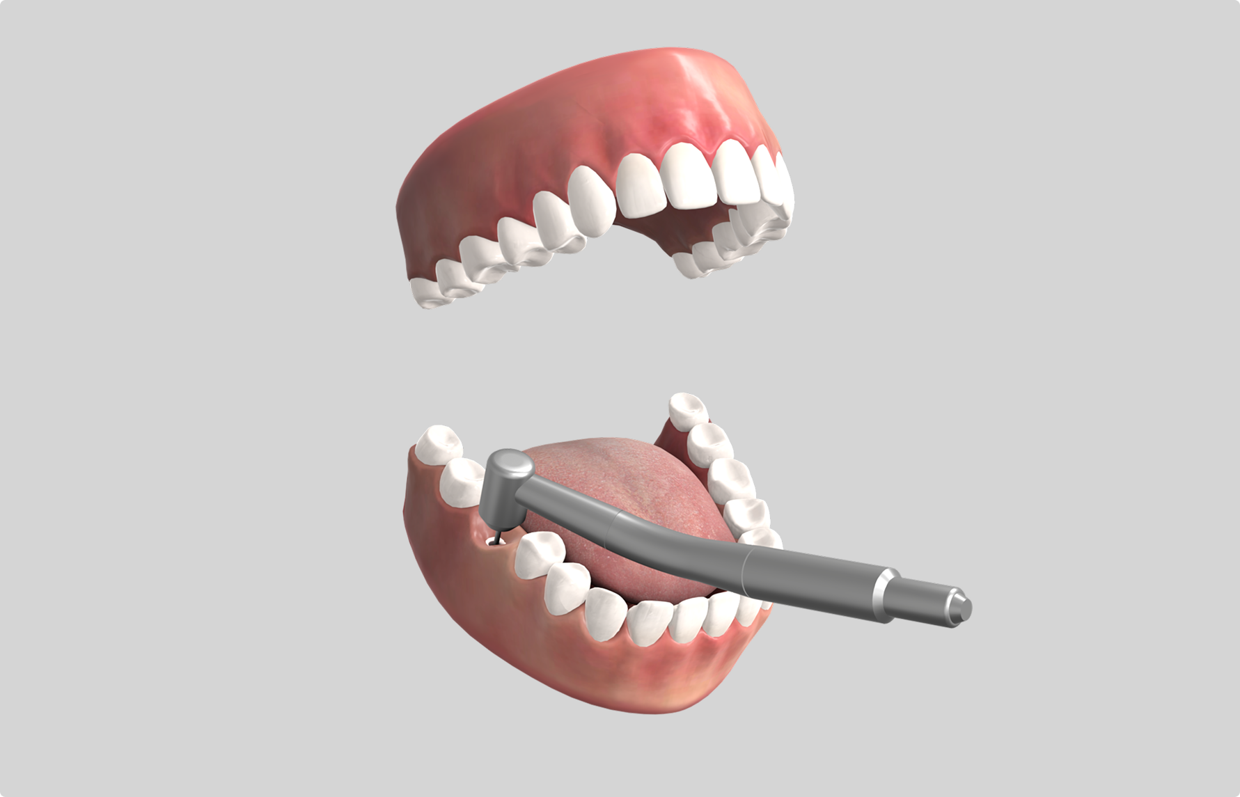 Dental drill in mouth, procedure step